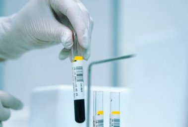 Ученые нашли способ предсказывать тяжелые формы инсульта у пациентов Ученые нашли способ предсказывать тяжелые формы инсульта у пациентов
